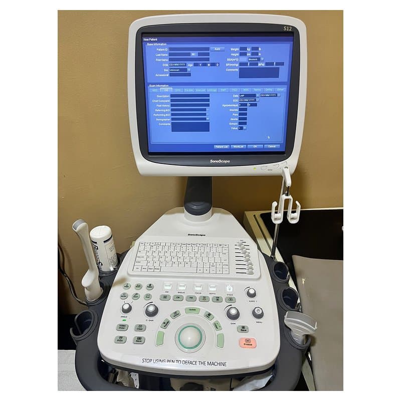 جهاز موجات فوق صوتية محمول Versana